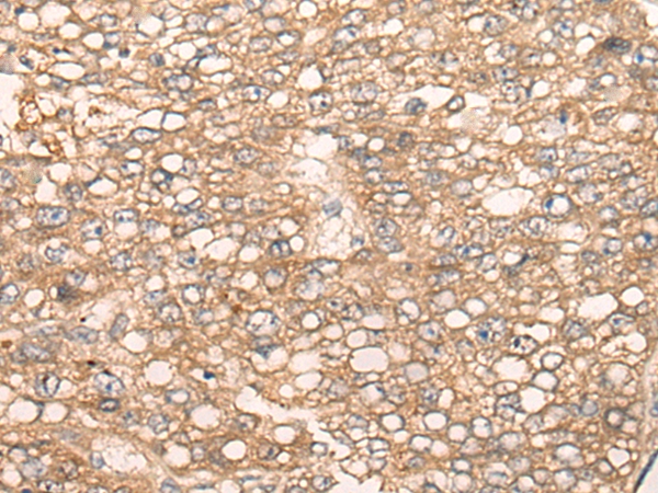SLC5A8 Antibody