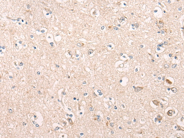 SOGA1 Antibody