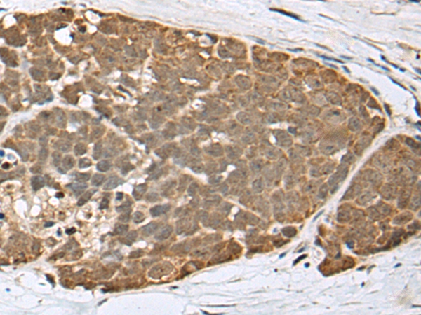 SPRTN Antibody