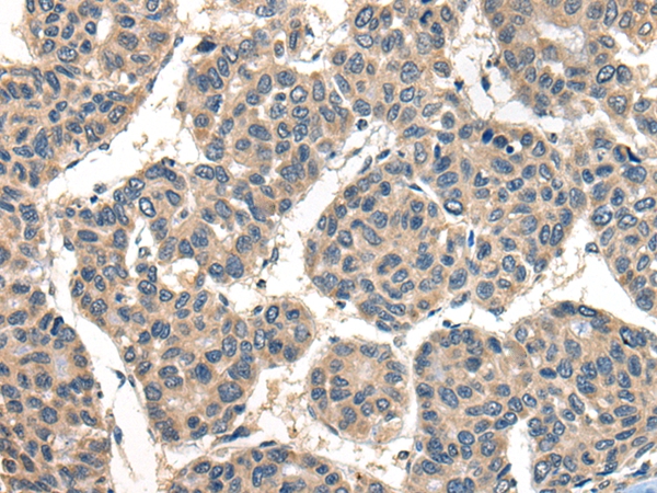 TACR3 Antibody
