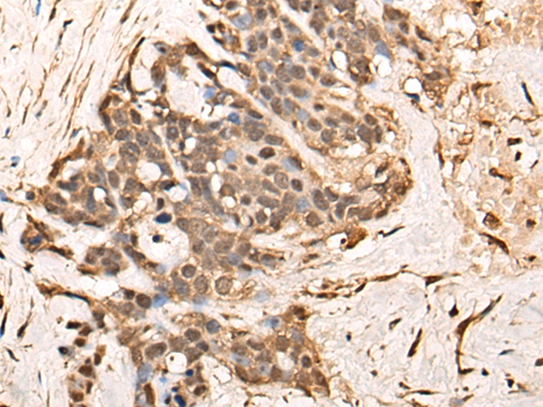 TCEAL9 Antibody