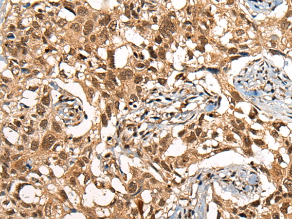 THOC6 Antibody