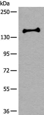UTY Antibody