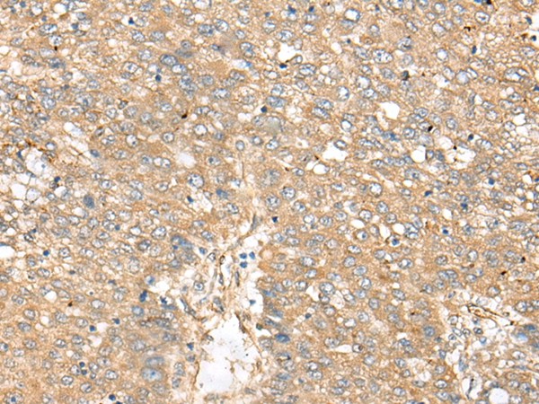 XPO6 Antibody