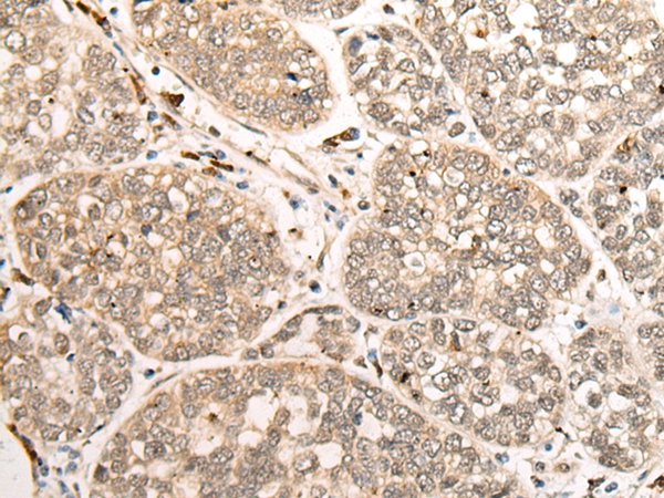 ZNF41 Antibody