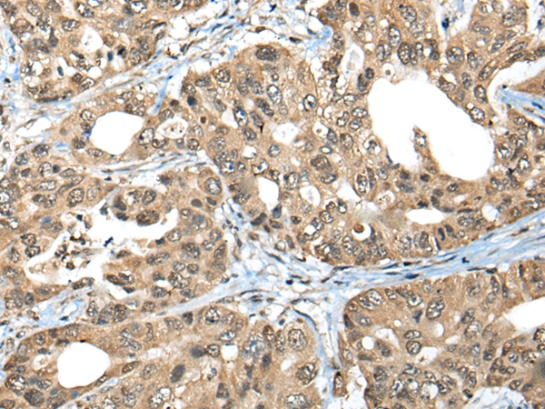 ZNF468 Antibody