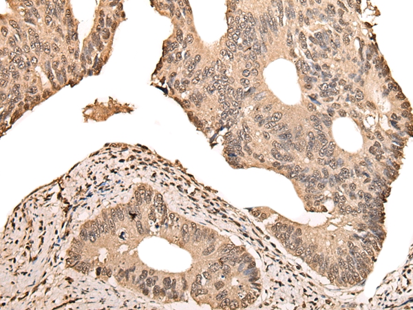 ZSCAN12 Antibody