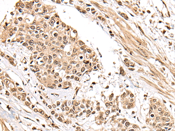 ZSCAN29 Antibody