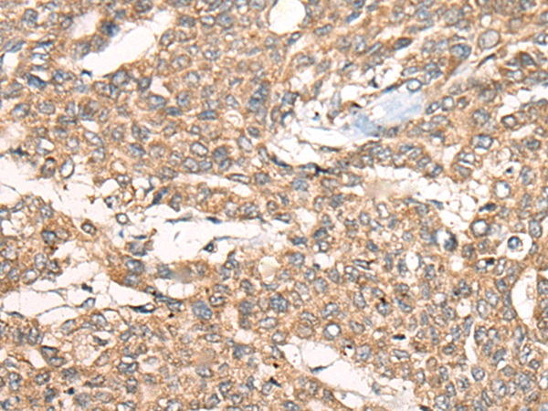 ZXDA Antibody