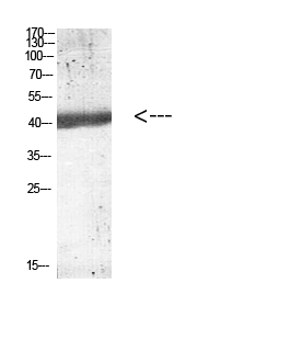 IL2B p40 Polyclonal Antibody