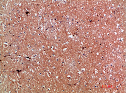 Tenascin-R Polyclonal Antibody