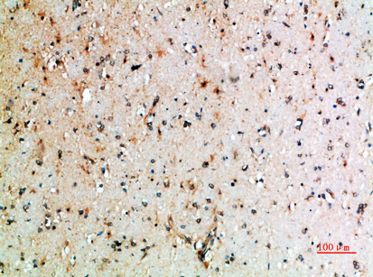 CD152 Polyclonal Antibody