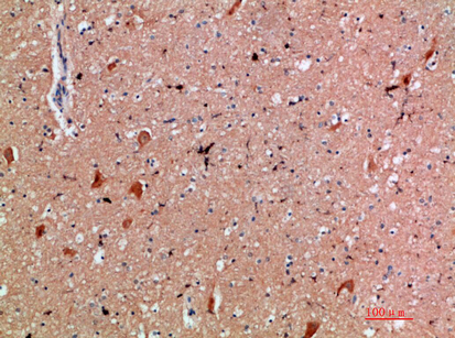 CD300e Polyclonal Antibody