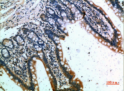 CKR Polyclonal Antibody