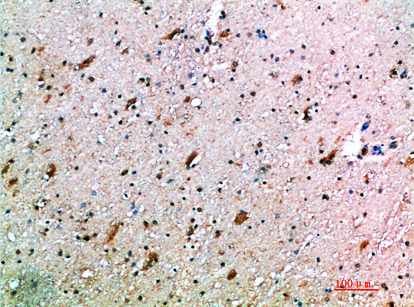 CD314 Polyclonal Antibody