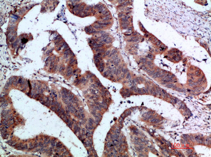 ILF7 Polyclonal Antibody