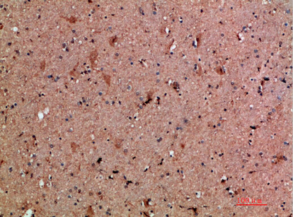 NNT Polyclonal Antibody