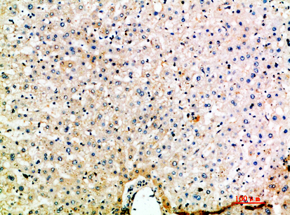 MIP-5 Polyclonal Antibody