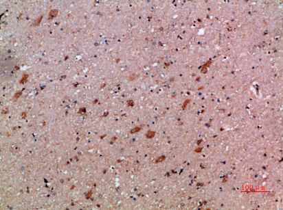 SDF Polyclonal Antibody