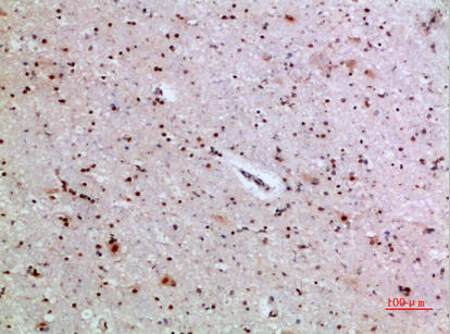 ILF6 Polyclonal Antibody