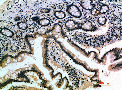 IL7B Polyclonal Antibody