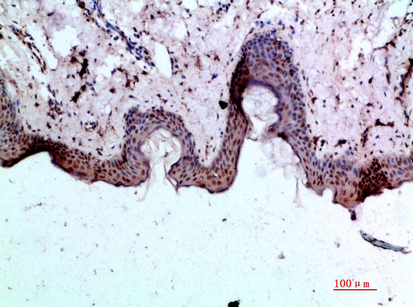 BMP Polyclonal Antibody
