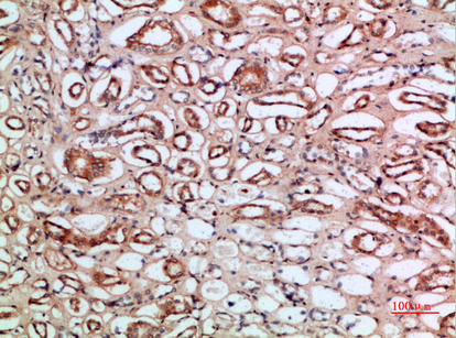 Tetranectin Polyclonal Antibody