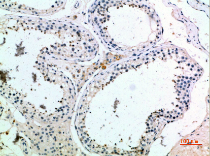 PMCH Polyclonal Antibody