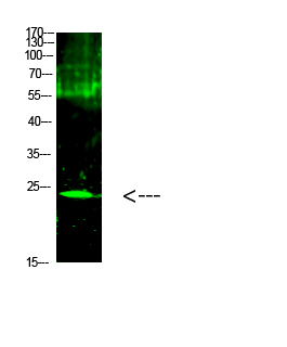 Cardiotrophin Polyclonal Antibody