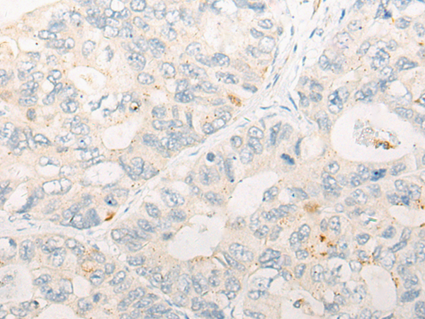 CCNJ Antibody