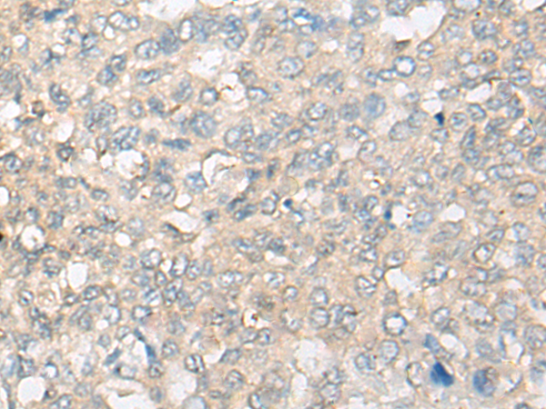 CLUL1 Antibody