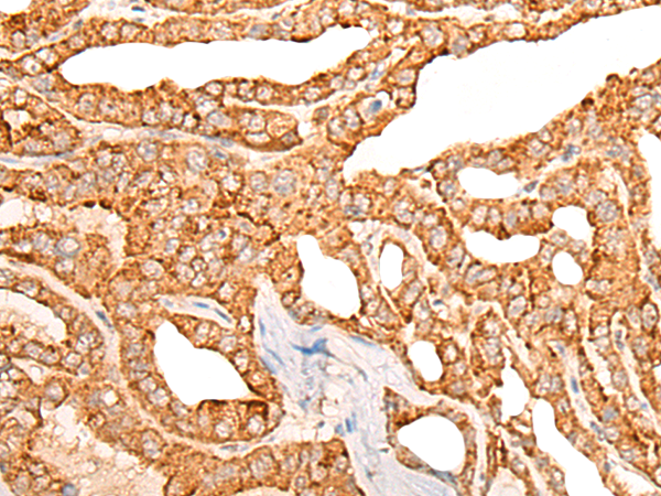 COX4I2 Antibody