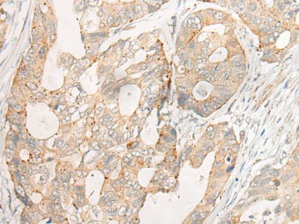 CPVL Antibody