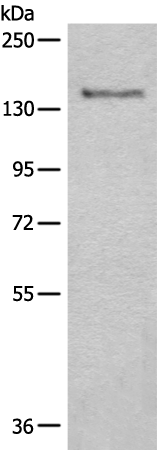 CTR9 Antibody