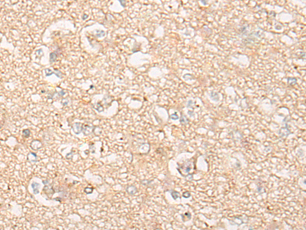 CYP26B1 Antibody