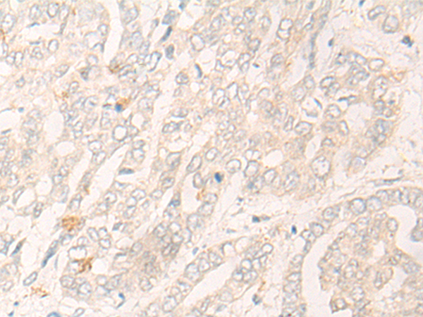 CYP2C19 Antibody