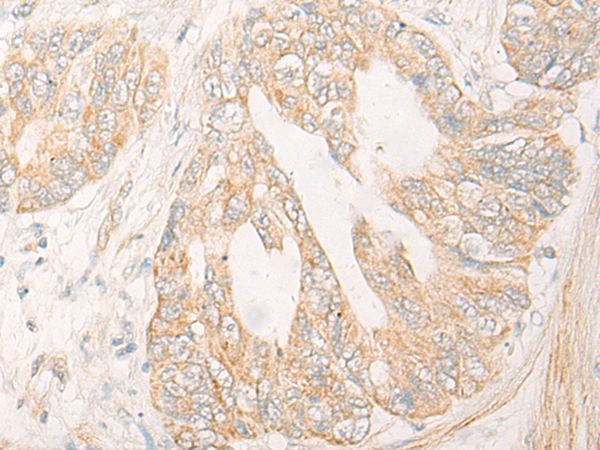 CYP4F12 Antibody