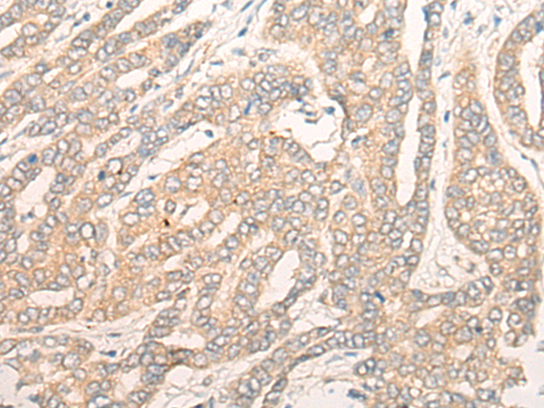 DALRD3 Antibody