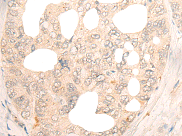 DBX2 Antibody