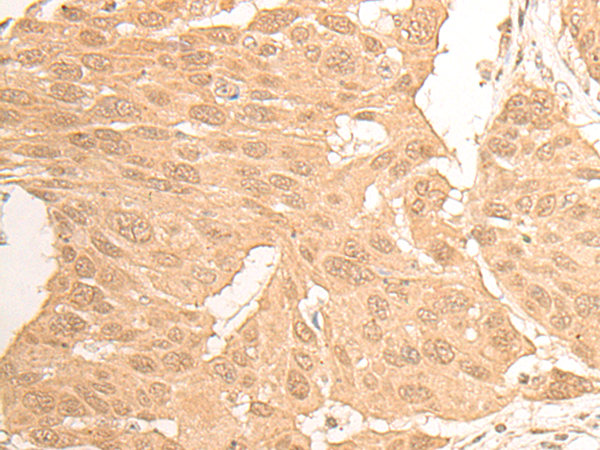 DCAF13 Antibody