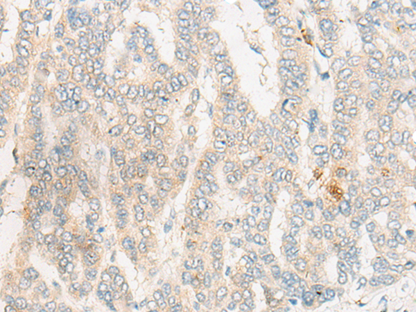 DCAF17 Antibody