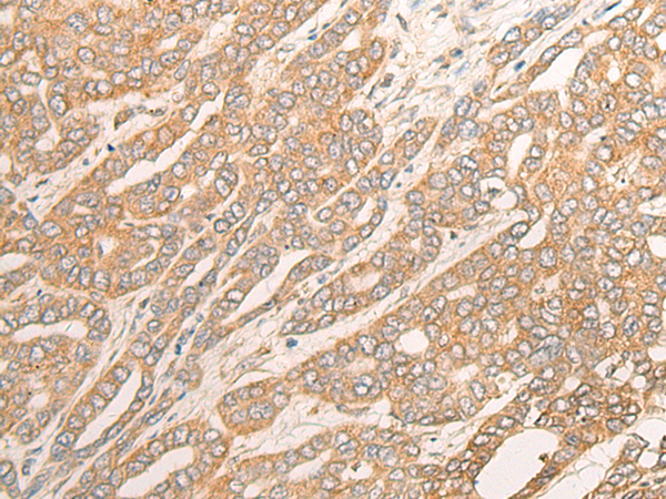 DCTD Antibody
