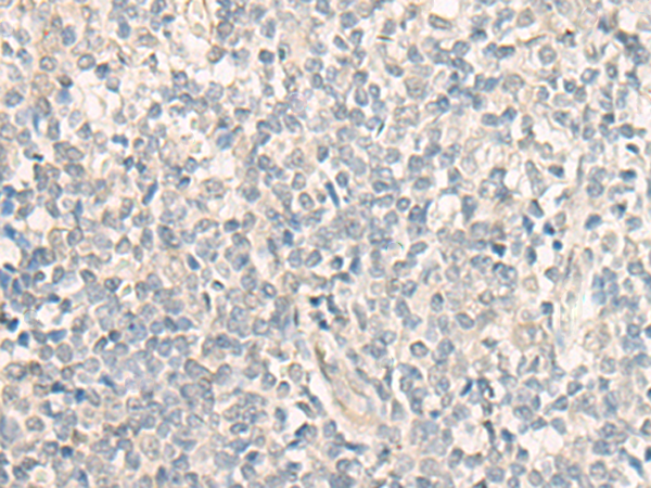 DFNA5 Antibody