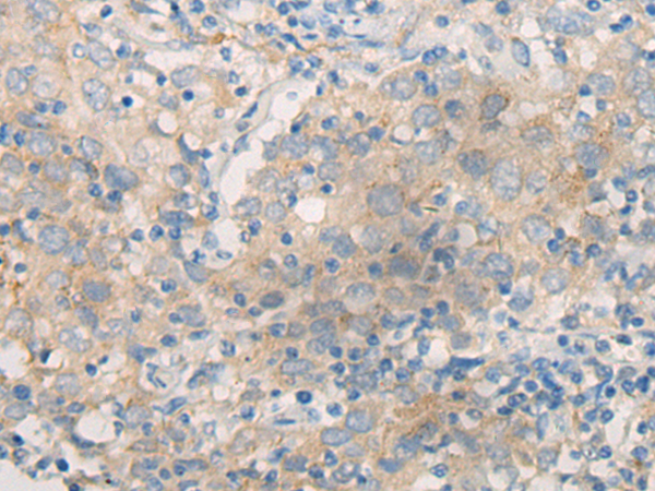 DLL3 Antibody