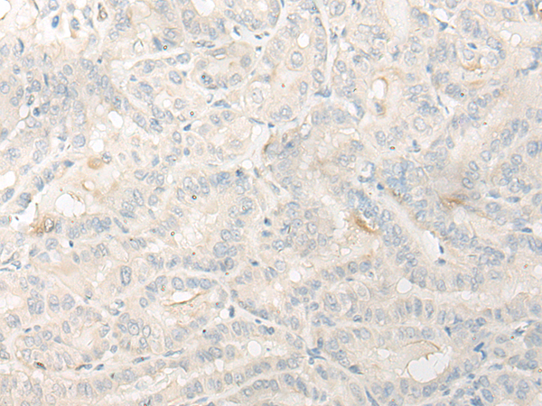 DNASE1L1 Antibody