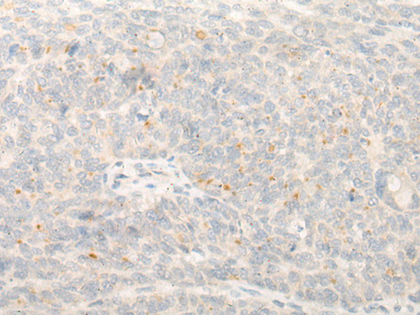 DND1 Antibody