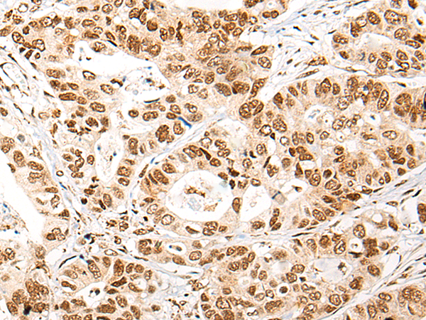 DNTT Antibody