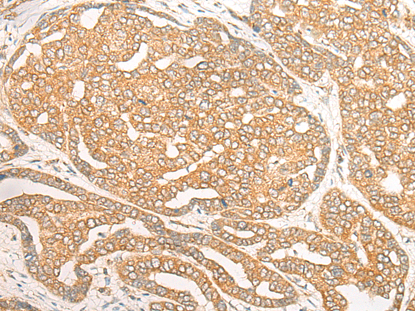 DOC2B Antibody