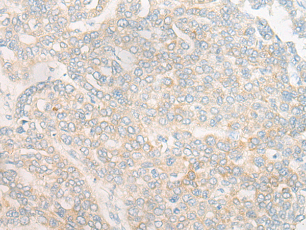 DOCK11 Antibody