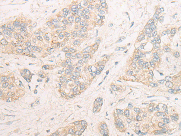DOCK9 Antibody